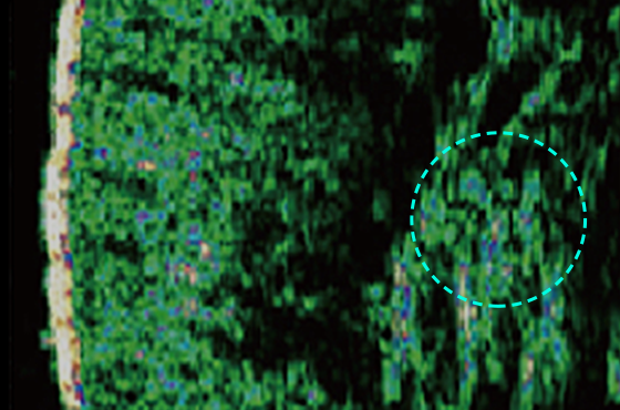 Dermis density and thickness About 62% better