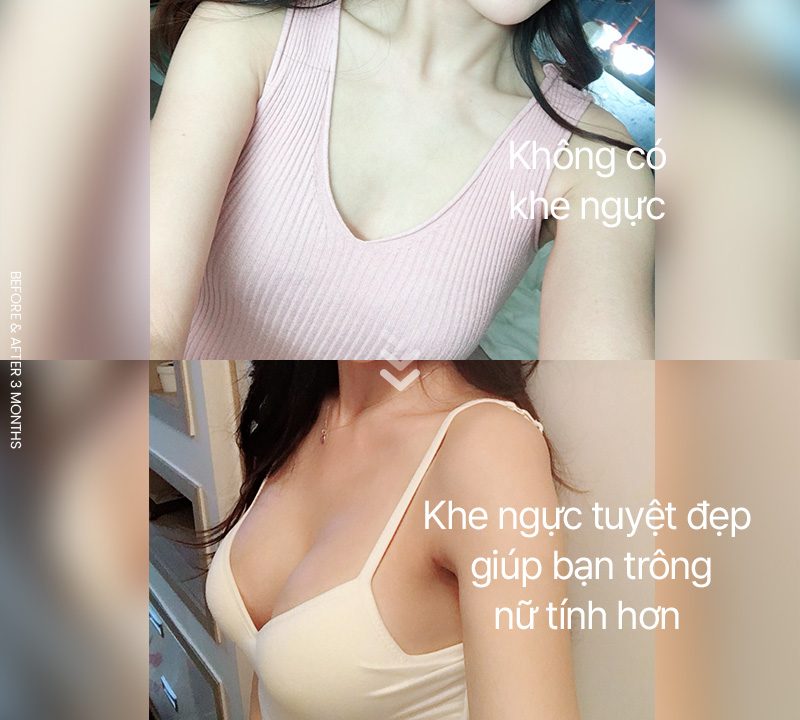 Không có khe ngực