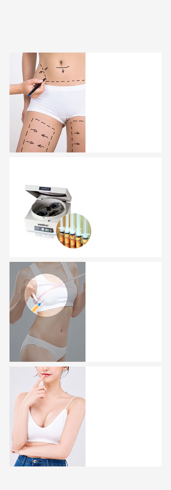 Thủ thuật Fat-Bra STEP 01 Tư vấn và lập kế hoạch phẫu thuật STEP 02 Thu mỡ STEP 03 Tiêm mỡ micro STEP 04 Tăng kích thước ngực