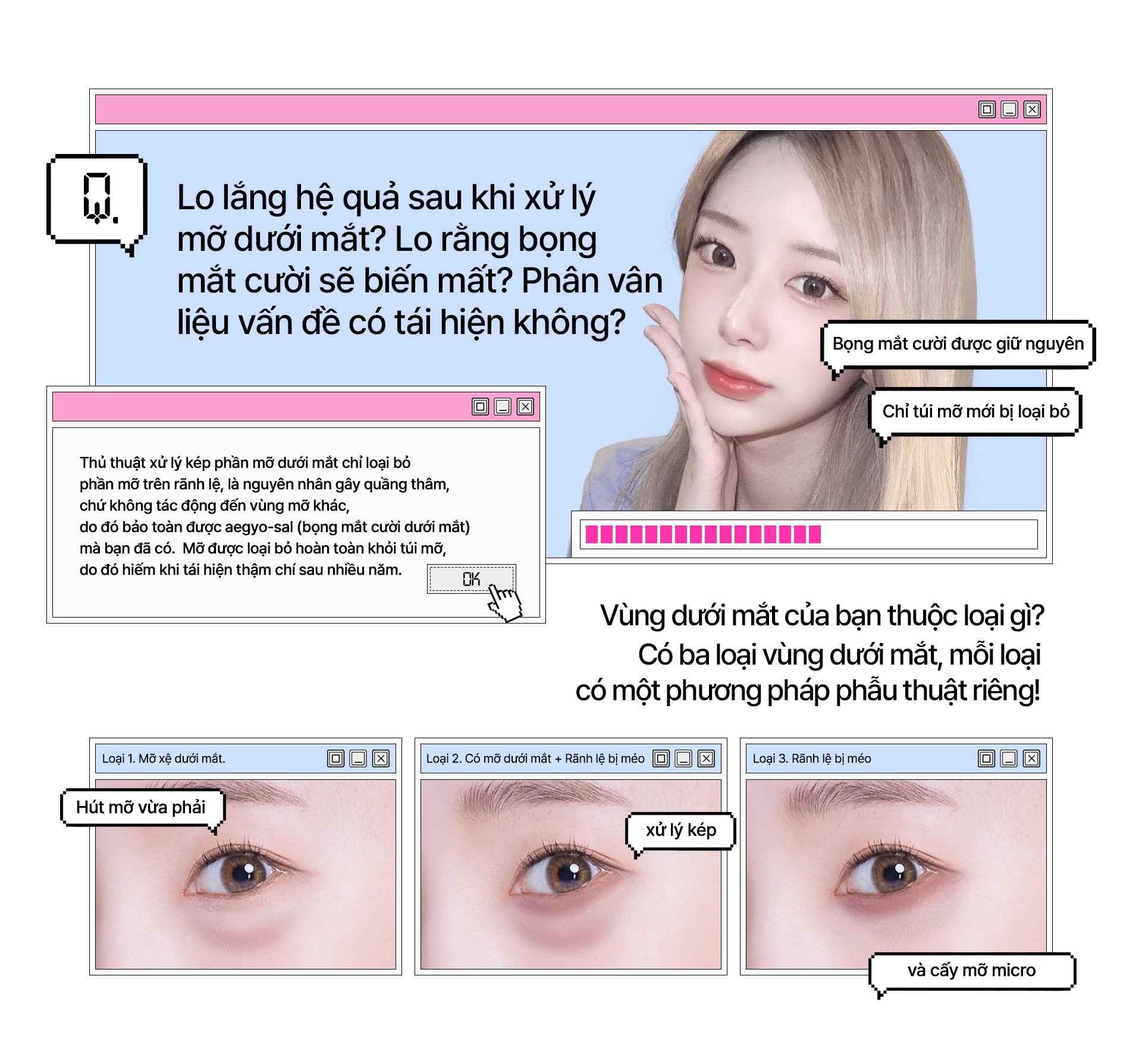 듀얼Hút mỡ dưới mắt는 다른 부위의 지방은 건드리지 않고 다크써클의 원인이 되는 눈물 고랑 위쪽의 지방만 제거하여 내가 가지고 있는 예쁜 애교살은 보존합니다. 완벽한 지방주머니의 지방제거로 몇 년이 지나도 재발하는 일은 거의 없습니다.