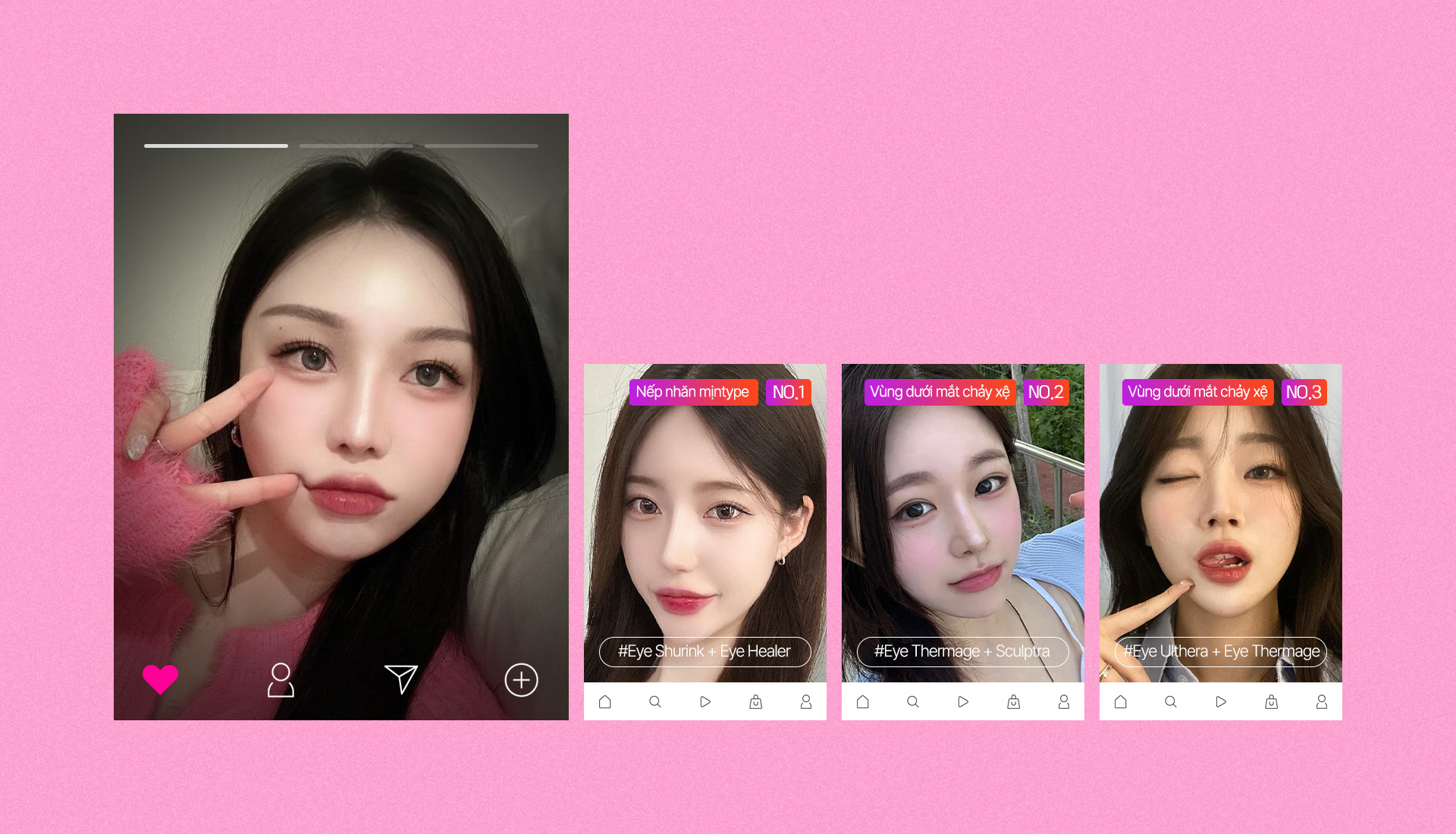 #회복시간이 없고 #수술이 두렵다면 정답은?! 세이예스 Dưới mắt팽팽 패키지