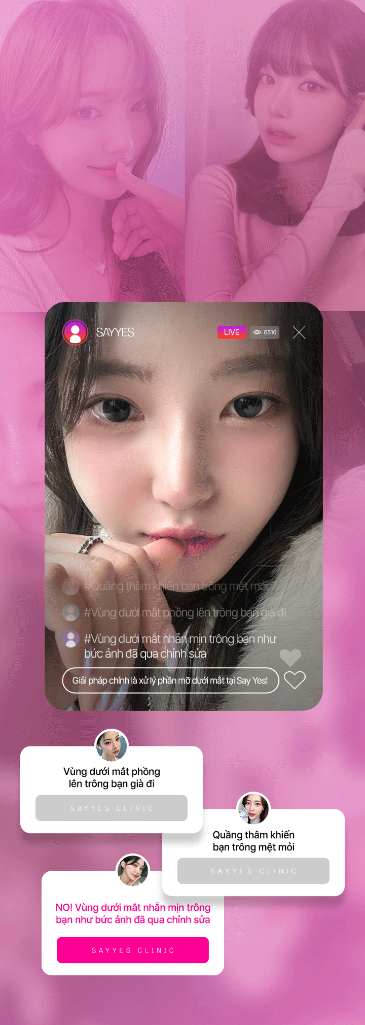 어려보이는 얼굴라인은 Dưới mắt부터 시작한다 Dưới mắt지방 재배치