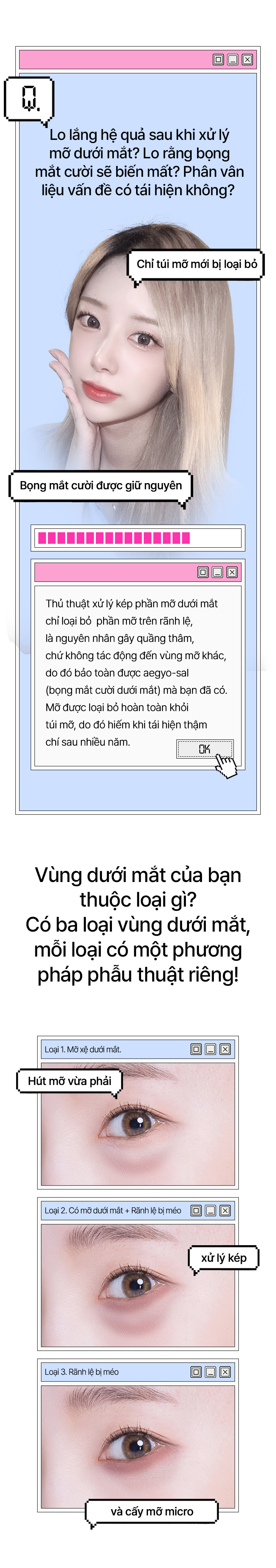 듀얼Hút mỡ dưới mắt는 다른 부위의 지방은 건드리지 않고 다크써클의 원인이 되는 눈물 고랑 위쪽의 지방만 제거하여 내가 가지고 있는 예쁜 애교살은 보존합니다. 완벽한 지방주머니의 지방제거로 몇 년이 지나도 재발하는 일은 거의 없습니다.