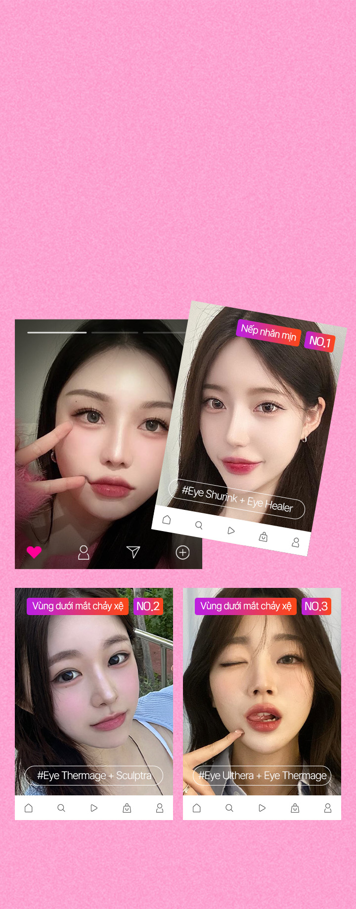 #회복시간이 없고 #수술이 두렵다면 정답은?! 세이예스 Dưới mắt팽팽 패키지