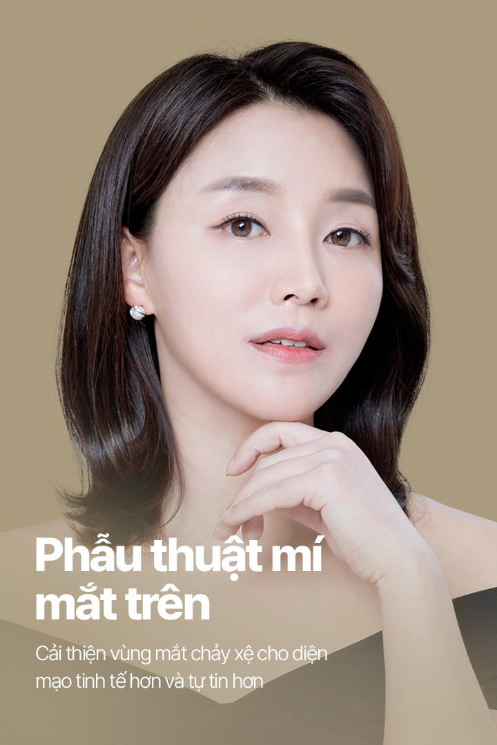 Phẫu thuật mí mắt trên Mắt xệ 개선, 눈매를 또렷하게 자신감 넘치는 눈매