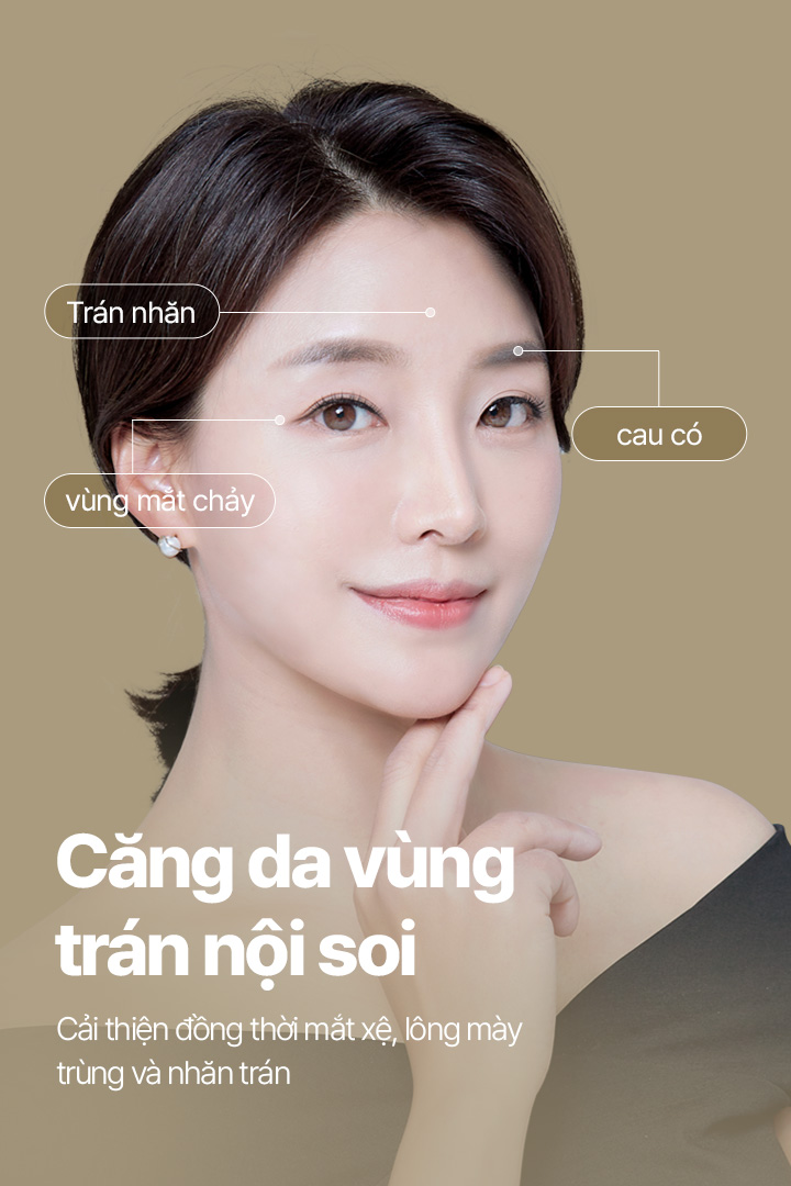 내시경 Căng da vùng trán 처진눈매 / 처진눈썹 / Nếp nhăn vùng trán 동시에 개선
