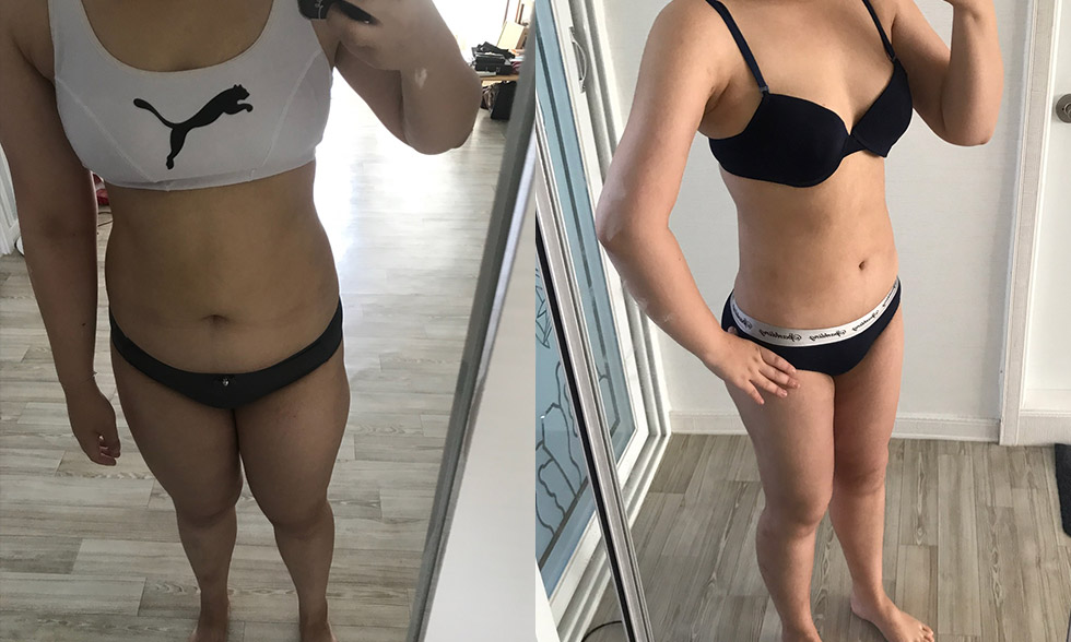 Tất cả trong một! Rút tối đa 4.000 cc mỡ từ vùng mong muốn Mega Look Fat Ảnh trước và sau