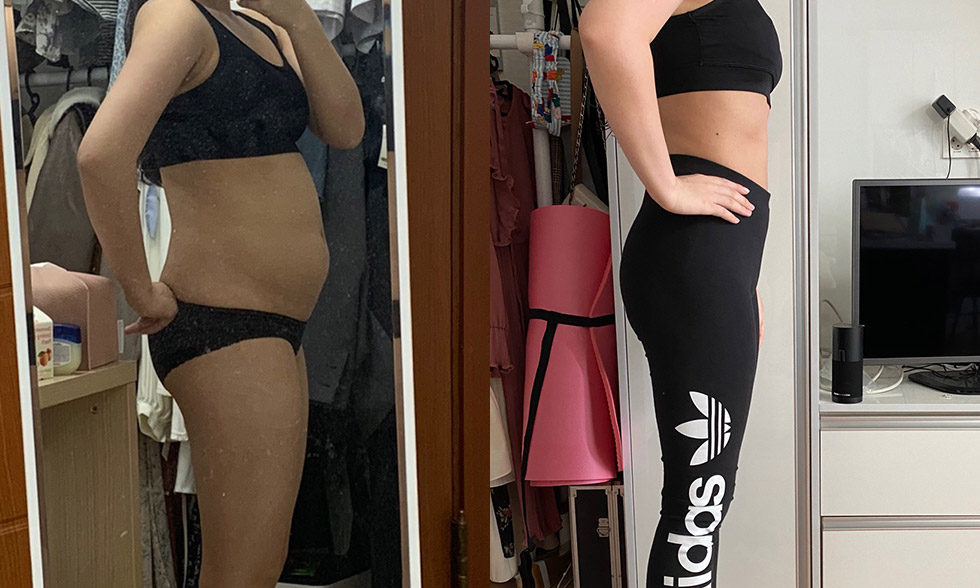 Tất cả trong một! Rút tối đa 4.000 cc mỡ từ vùng mong muốn Mega Look Fat Ảnh trước và sau