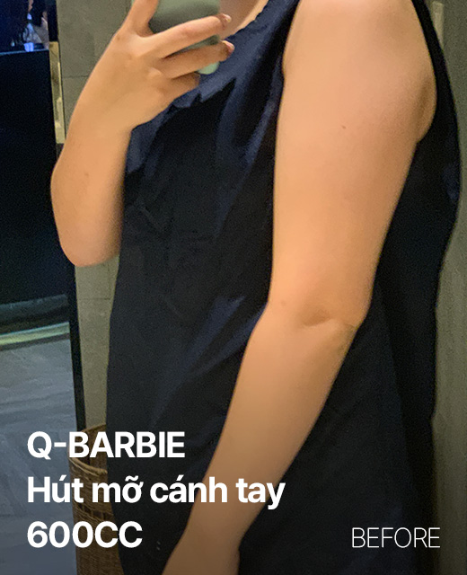 Ảnh trước và sau