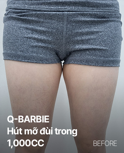 Ảnh trước và sau