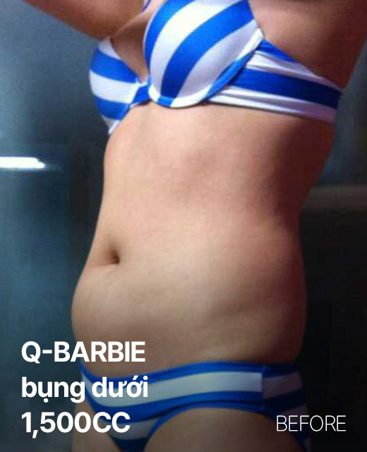 Ảnh trước và sau