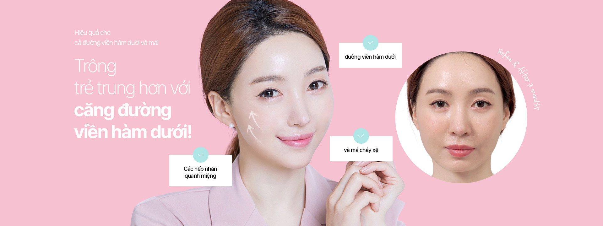 Hiệu quả cho cả đường viền hàm dưới và má!  Căng đường viền hàm dưới