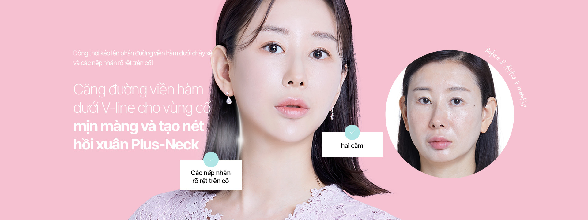 Đồng thời kéo lên phần đường viền hàm dưới chảy xệ và các nếp nhăn rõ rệt trên cổ!Căng đường viền hàm dưới V-line cho vùng cổ mịn màng và tạo nét hồi xuân Plus-Neck 
