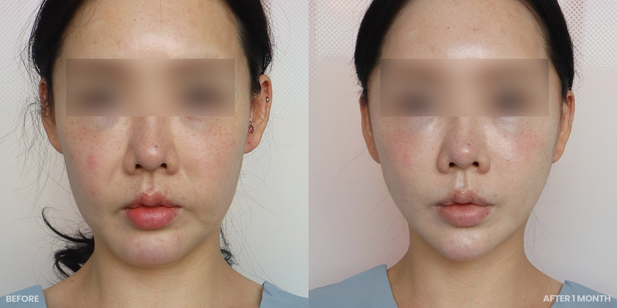 Hình ảnh trước và sau