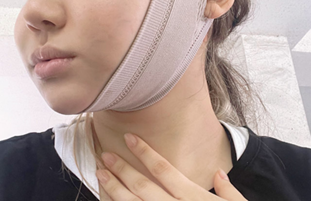 Băng căng da được cung cấp Băng căng da, giúp giảm sưng và tạo nét đường viền dưới hàm đẹp hơn, được cung cấp miễn phí.