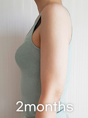 LookFat, chỉ loại bỏ phần mỡ Ảnh trước và sau