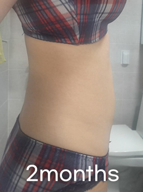 LookFat, chỉ loại bỏ phần mỡ Ảnh trước và sau
