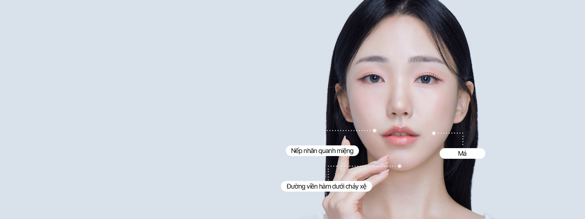 Căng đường viền hàm dưới mini 4X Căng đường viền hàm dưới mini giúp tạo dáng V line chỉ trong 30 phút bằng cách kéo căng hai cằm và đường viền hàm dưới bị chảy xệ! Căng da mini 4X tại Say Yes không chỉ kéo căng phần da ngoài, mà còn cả phần SMAS dưới lớp mỡ, đồng thời cố định nó theo chiều dọc một lần nữa bằng chỉ căng để tăng hiệu quả!