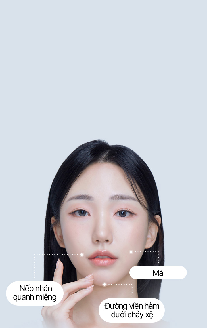 Căng đường viền hàm dưới mini 4X Căng đường viền hàm dưới mini giúp tạo dáng V line chỉ trong 30 phút bằng cách kéo căng hai cằm và đường viền hàm dưới bị chảy xệ! Căng da mini 4X tại Say Yes không chỉ kéo căng phần da ngoài, mà còn cả phần SMAS dưới lớp mỡ, đồng thời cố định nó theo chiều dọc một lần nữa bằng chỉ căng để tăng hiệu quả!