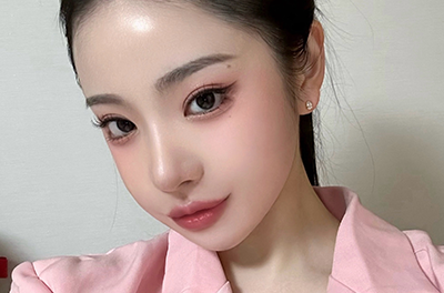 Xương gò má mềm mại
