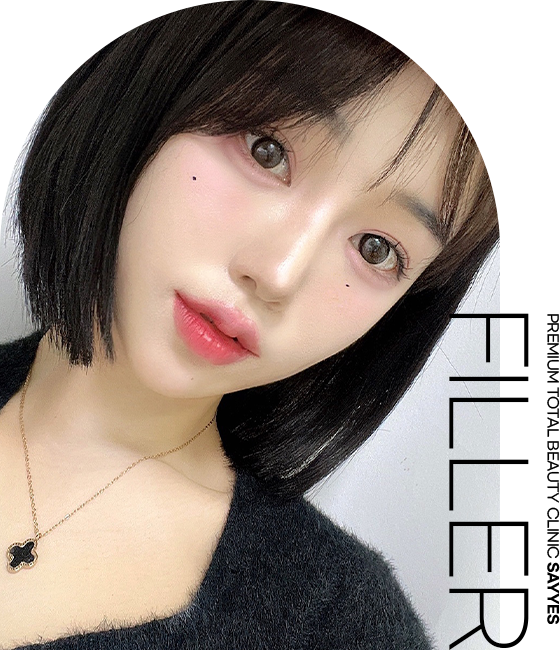 Filler Tiêm filler có chứa hyaluronic acid tương tự như có trong cơ thể người vào các vị trí trên khuôn mặt cần tăng dung tích hoặc có nếp nhăn sâu để lấp đầy các vùng chảy xệ.
