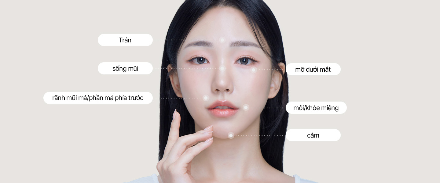 Trán, sống mũi, rãnh mũi má/phần má phía trước, mỡ dưới mắt, môi/khóe miệng, cằm