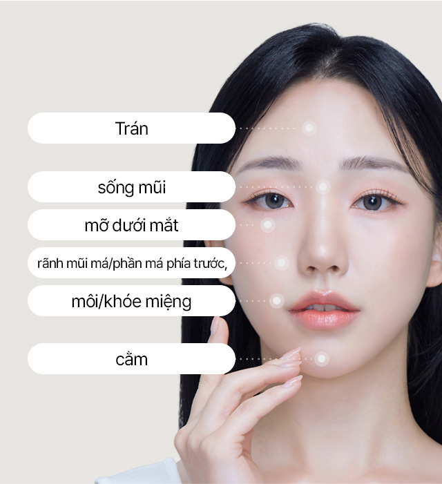 Trán, sống mũi, rãnh mũi má/phần má phía trước, mỡ dưới mắt, môi/khóe miệng, cằm